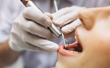 Endodonti