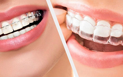 Ortodontik Tedavi Aygıtları